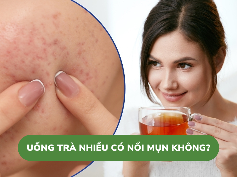 uống trà nhiều có nổi mụn không